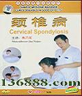 ҽĦβϵ ׵ (Cervical Spondylosis)DVD  [1DVD]