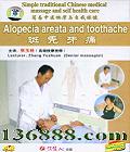 ҽĦұ ͺʹ (Alopecia areata and toothache)DVD  [1DVD]